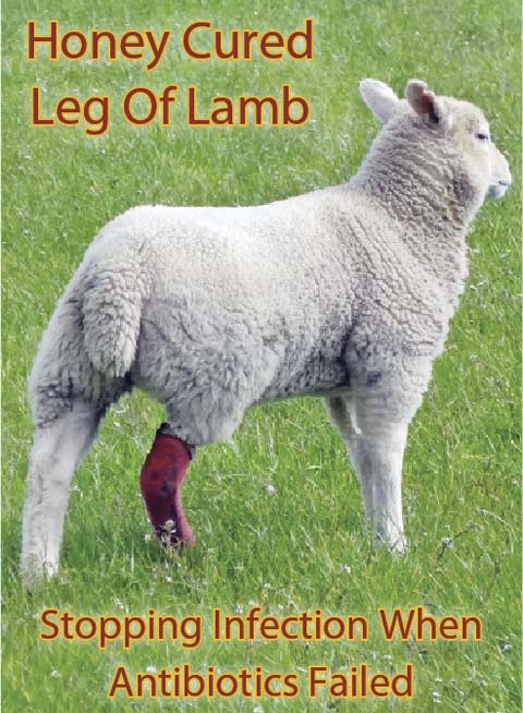 Honey Cured Leg Of Lamb: Stopping Infection When Antibiotics Failed